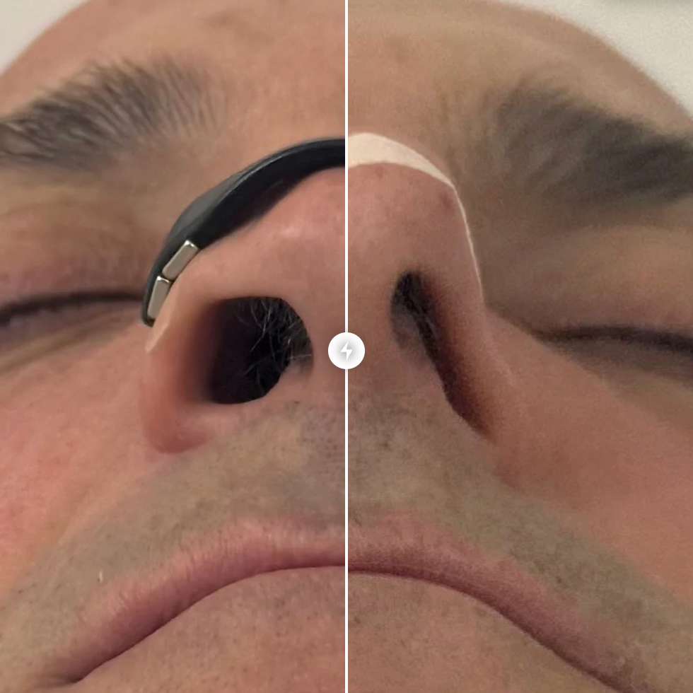 Wspiera naturalną strukturę nosa